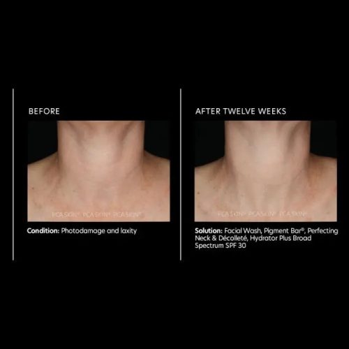 perfecting neck decollete 1